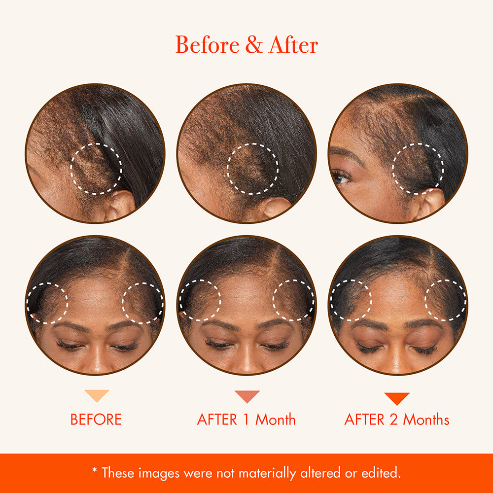 Growth MD Scalp Ampoule .4 OZ - Elevate Styles