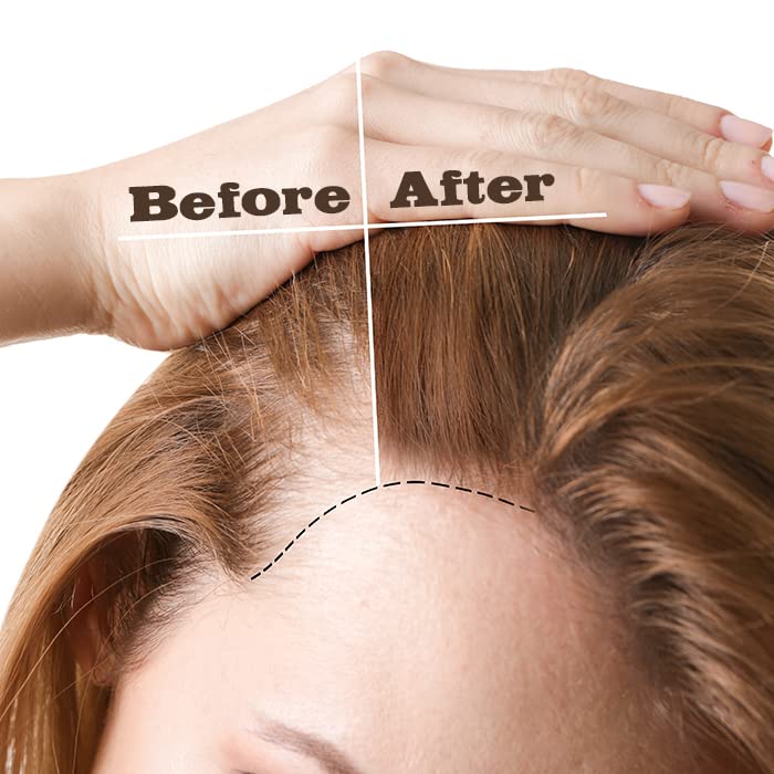 Ebin New York Wil + Gain Original Max Gro Hair Serum - Elevate Styles